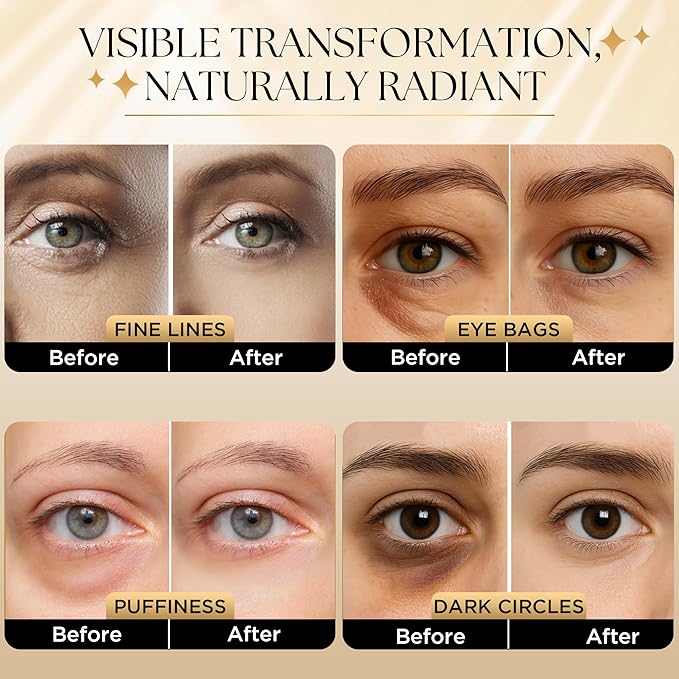 Undereye Mask Patches for Dark Circles, Puffiness & Wrinkles, Gold Eye Mask with Collagen, Caffeine & Hyaluronic Acid, Vegan & Cruelty-Free Eye Patches for Women and Men (24 Pairs)